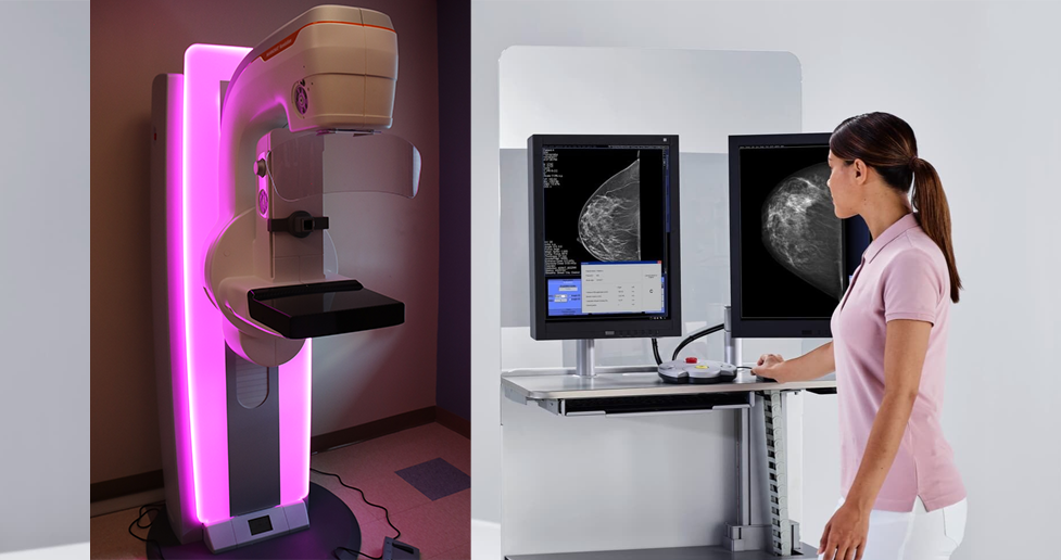 cta-bcc-3d-siemens-mammo